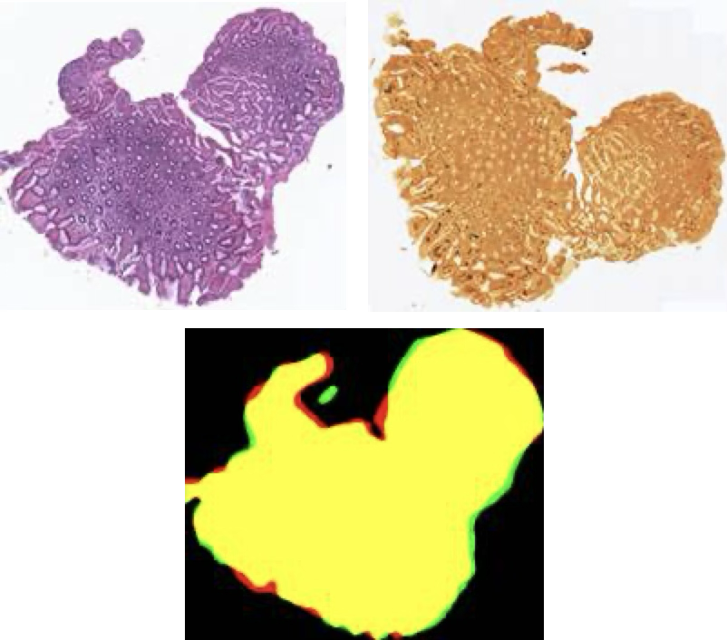 Fast registration algorithms for histological images